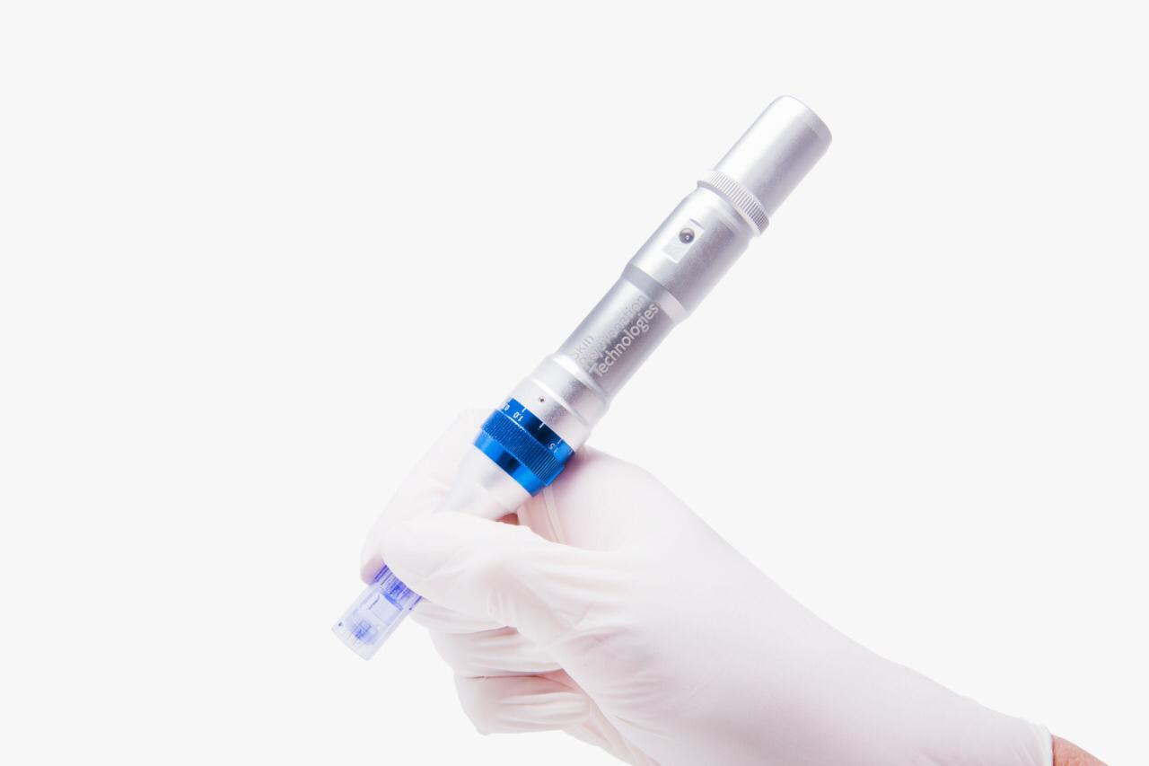 Microneedling or collagen induction therapy