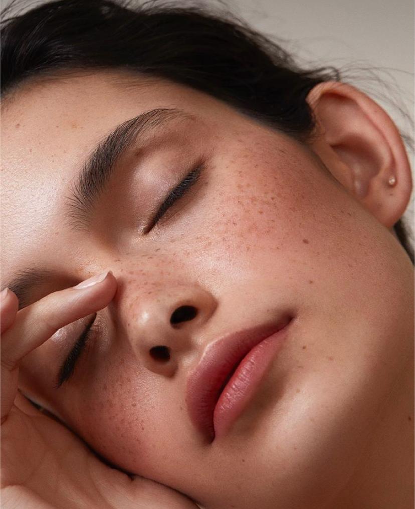 5 Reasons You Are Still Getting Acne In Your 30s
