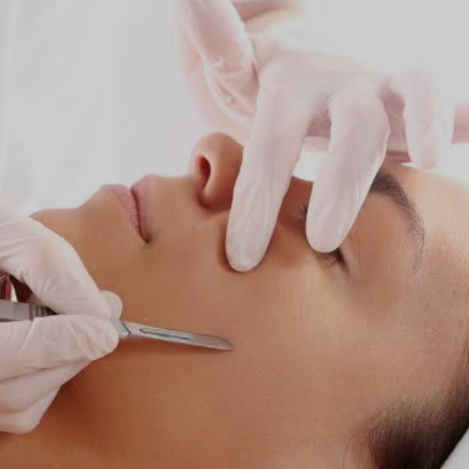 Dermaplaning